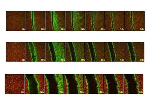 Strip view of scratch wound with timings